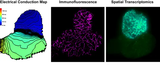 Crosstalk Among Gene Transcription, Metabolism, and Cellular Electrophysiology